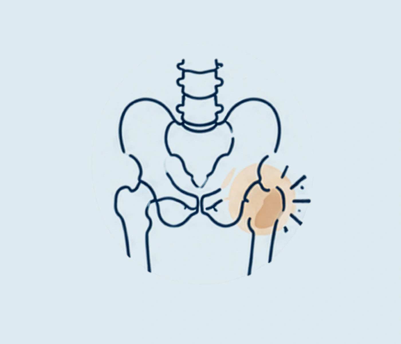 Hip pain v2.png