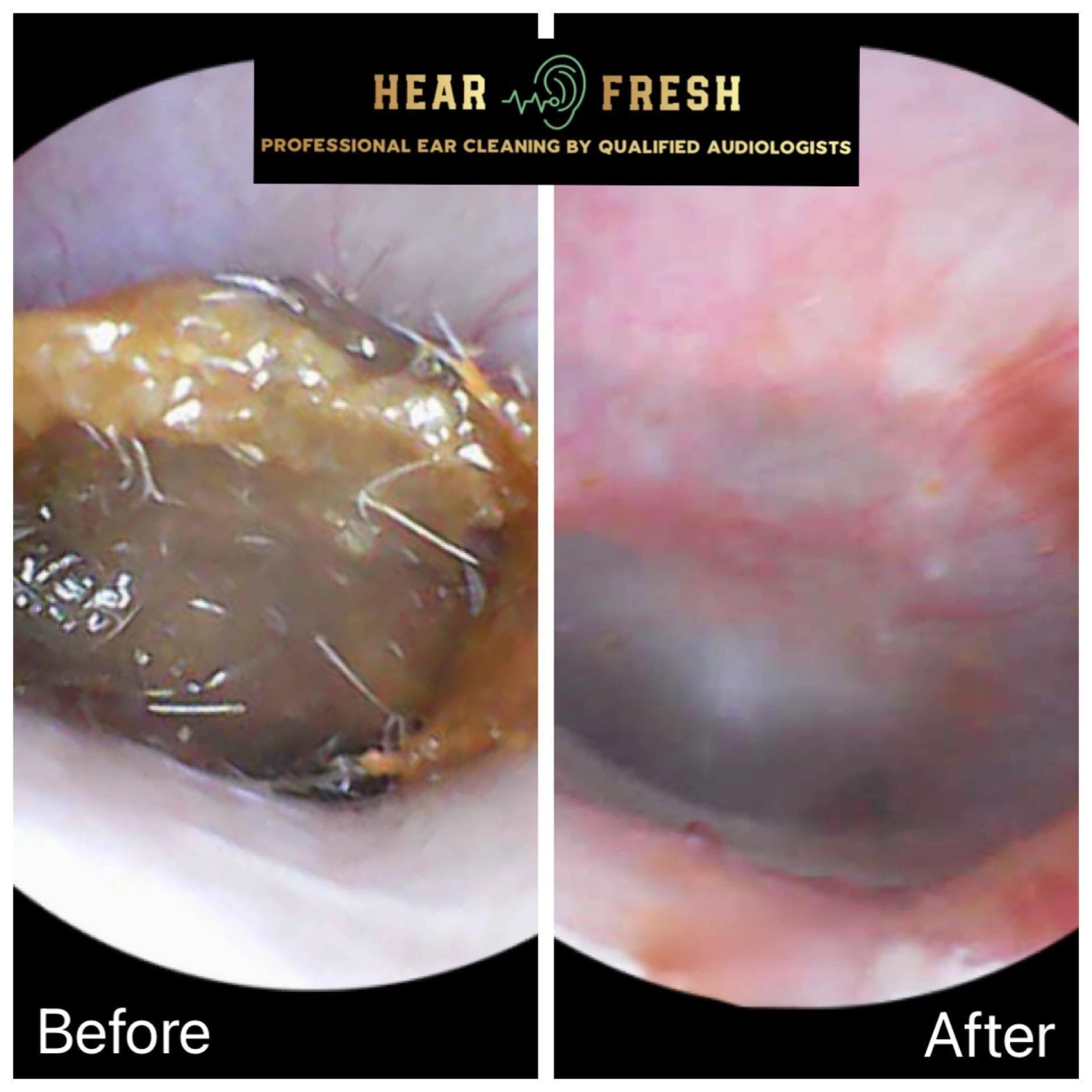 before and after2.JPG