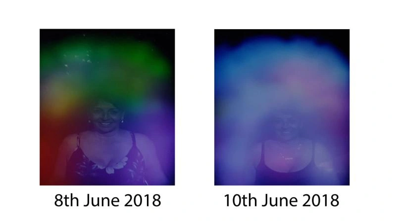 Aura photo before and after.jpg
