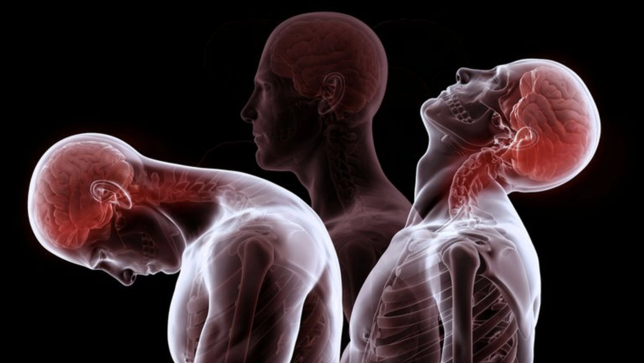 Whiplash Image skelleton.jpg