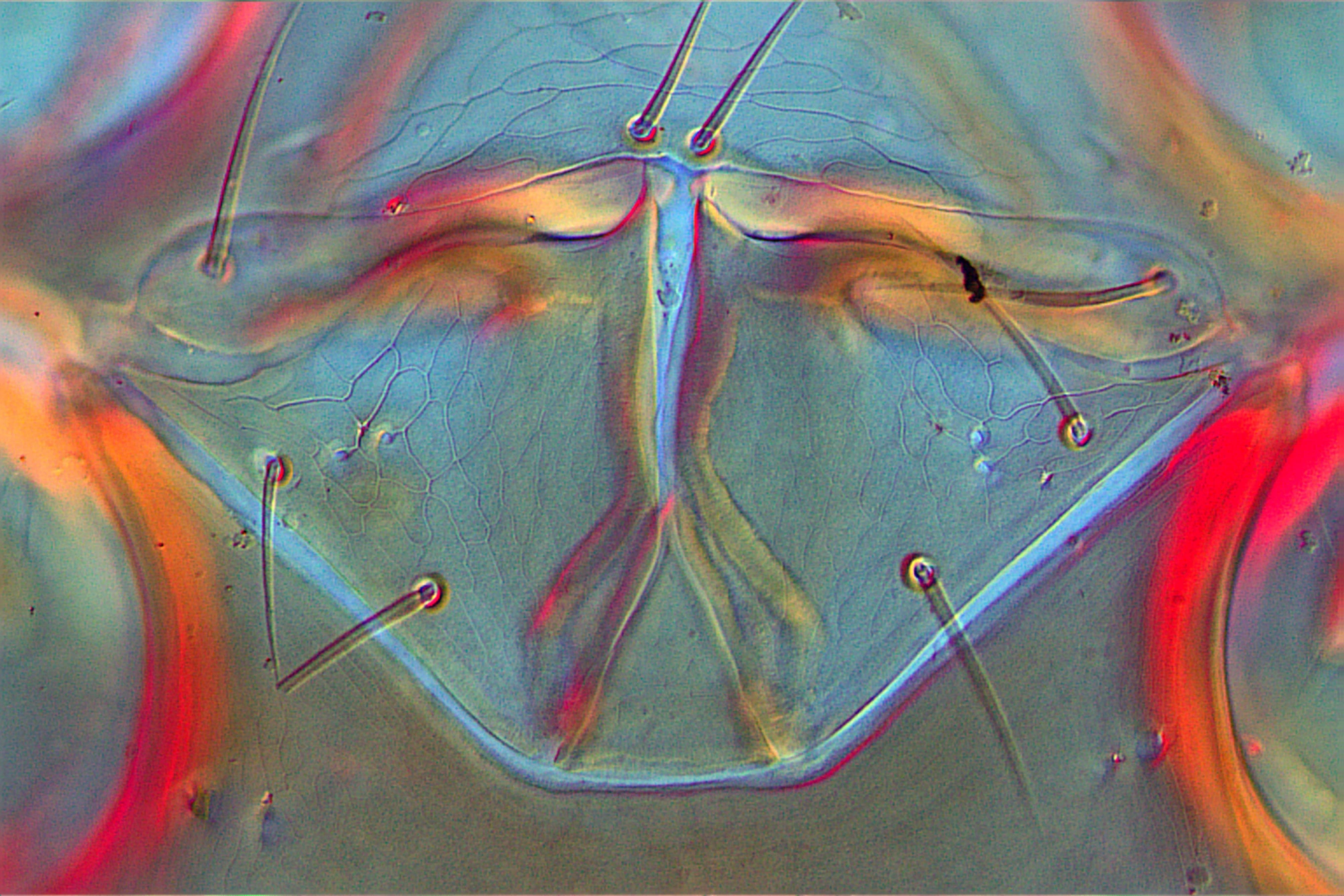 Cryptometasternum ex A teres x40 genital shield.jpg
