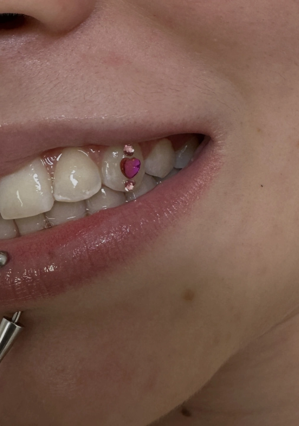 tooth gems 2.jpeg