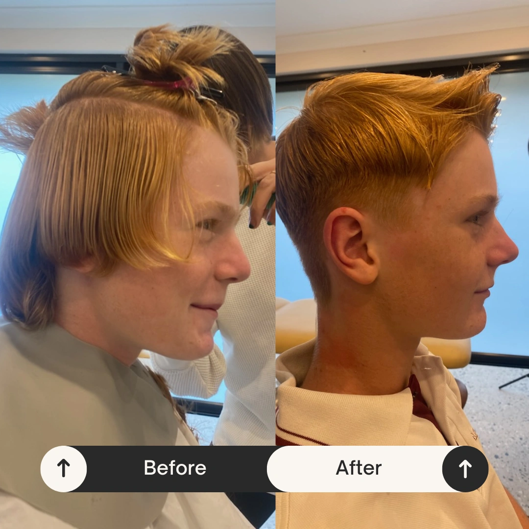 Beige Minimalist Skincare Before and After Instagram Post_20260514_182733_0000.png