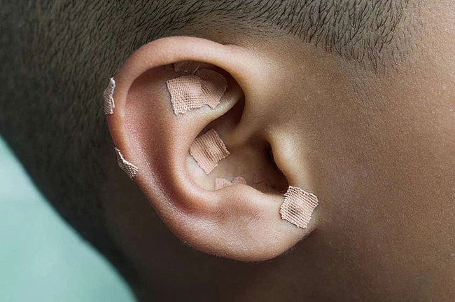 auriculoterapia.jpg