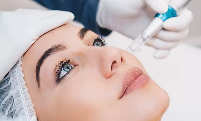 skin-prx-needling-3-1.jpg copy.png