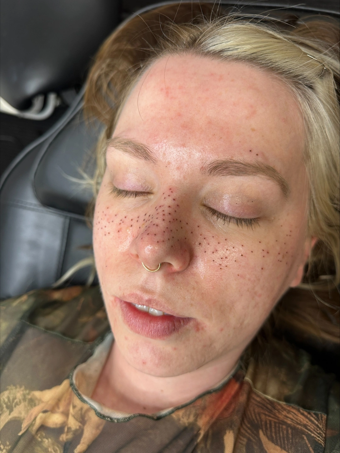 PMU Freckles.jpg