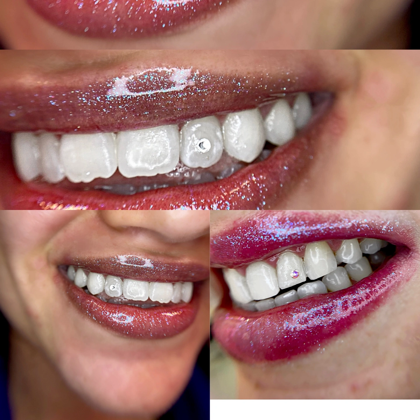 tooth gems new.JPG